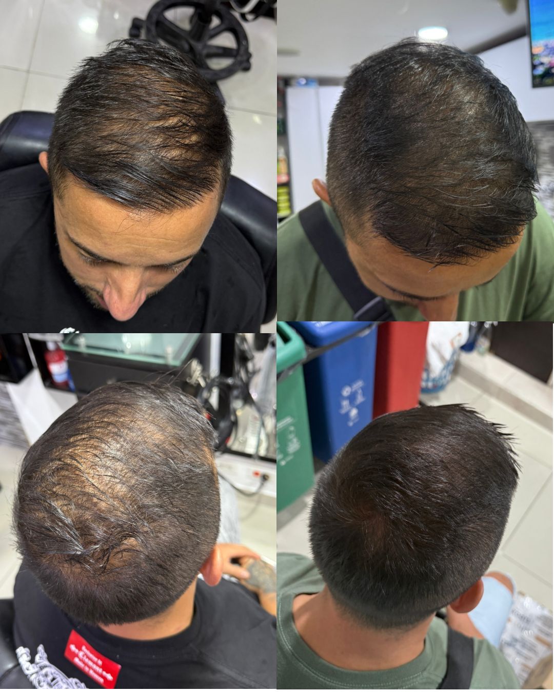 Combo Shampoo Revital + Tonico Abundia Capilar