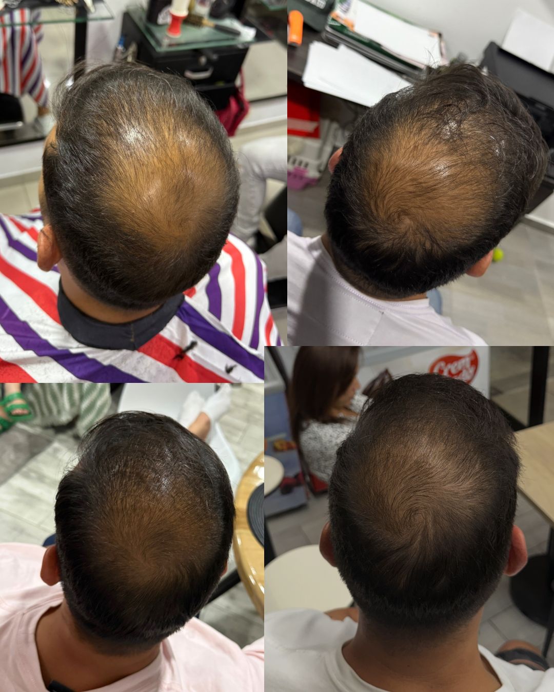 Combo Shampoo Revital + Tonico Abundia Capilar